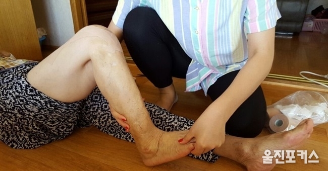 울진군(군수 전찬걸)은 초고령화 사회 어르신들의 삶의 질을 향상시키기 위해 거동불편자를 대상으로 무릎인공관절수술 지원 신청을 받는다. (사진=울진군)